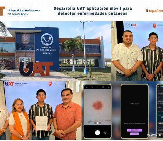 UAT desarrolla una aplicación móvil para detectar enfermedades de la piel